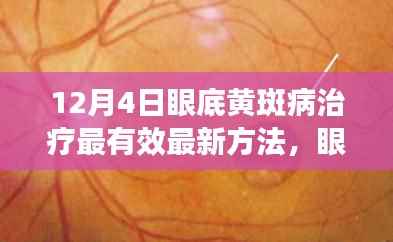 眼底黄斑病治疗最新方法深度探讨与观点阐述,有效治疗策略分析