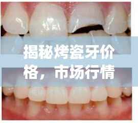 揭秘烤瓷牙价格,市场行情与费用解析